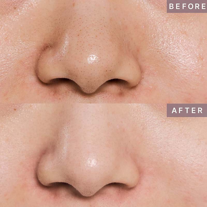 HB Pore Refining Mask Pack